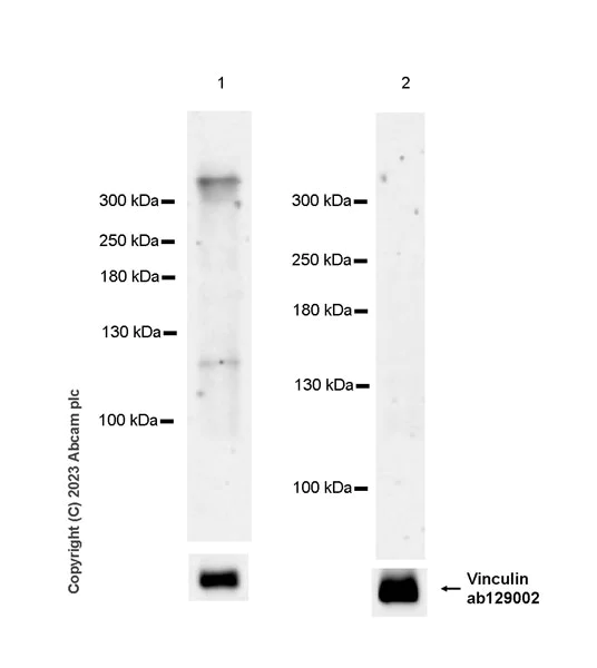 Western blot - Anti-BRCA2 antibody [EPR23442-43] (AB239375)