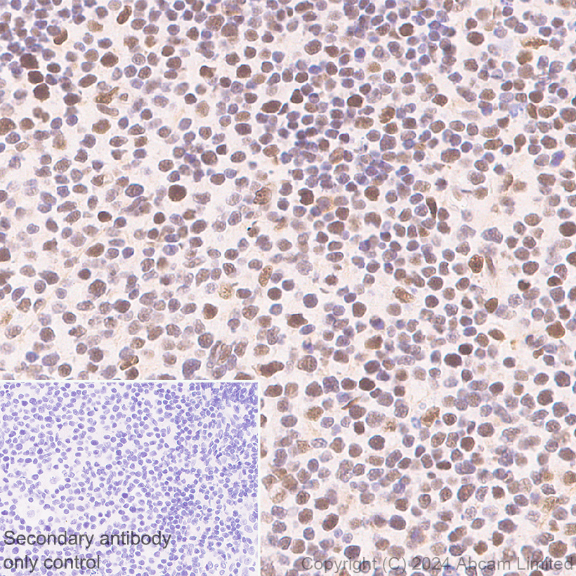 Immunohistochemistry (Formalin/PFA-fixed paraffin-embedded sections) - Anti-BRCA2 antibody [EPR26146-81] (AB322104), expandable thumbnail