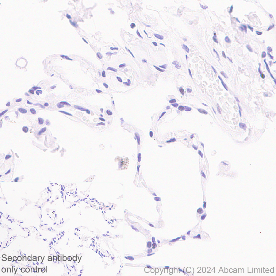 Immunohistochemistry (Formalin/PFA-fixed paraffin-embedded sections) - Anti-BRCA2 antibody [EPR26146-81] (AB322104), expandable thumbnail