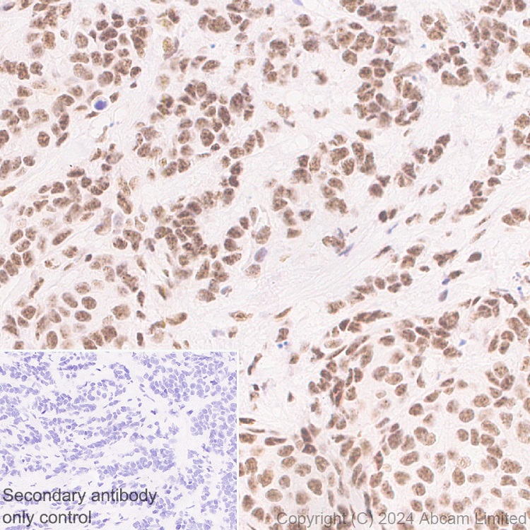 Immunohistochemistry (Formalin/PFA-fixed paraffin-embedded sections) - Anti-BRCA2 antibody [EPR26146-81] (AB322104), expandable thumbnail