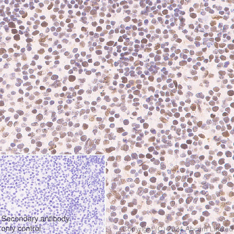 Immunohistochemistry (Formalin/PFA-fixed paraffin-embedded sections) - Anti-BRCA2 antibody [EPR26146-81] - BSA and Azide free (AB324804)