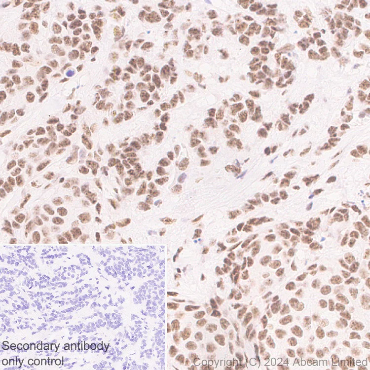 Immunohistochemistry (Formalin/PFA-fixed paraffin-embedded sections) - Anti-BRCA2 antibody [EPR26146-81] - BSA and Azide free (AB324804)