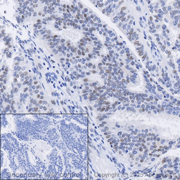 Immunohistochemistry (Formalin/PFA-fixed paraffin-embedded sections) - Anti-BRCA2 antibody [EPR26146-81] - BSA and Azide free (AB324804)