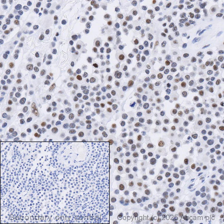 Immunohistochemistry (Formalin/PFA-fixed paraffin-embedded sections) - Anti-BRCA2 antibody [EPR26146-81] - BSA and Azide free (AB324804)