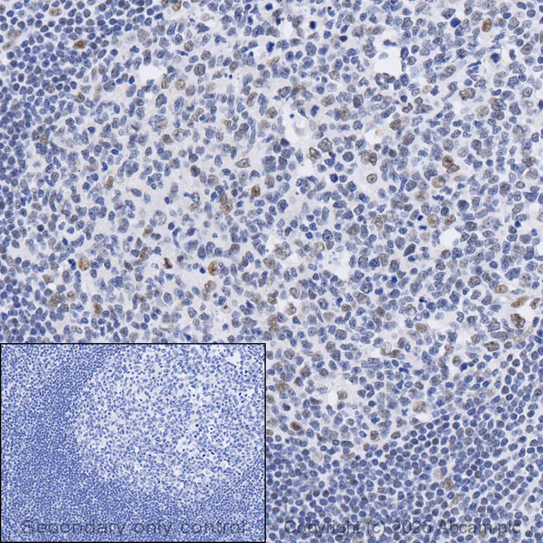 Immunohistochemistry (Formalin/PFA-fixed paraffin-embedded sections) - Anti-BRCA2 antibody [EPR26146-81] - BSA and Azide free (AB324804)