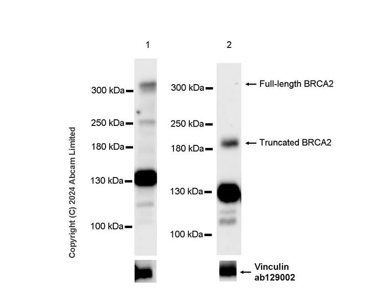 Western blot - Anti-BRCA2 antibody [EPR26146-81] - BSA and Azide free (AB324804)