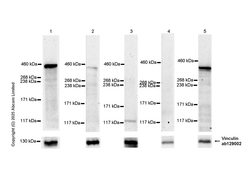 Western blot - Anti-BRCA2 antibody [EPR29007-533] - BSA and Azide free (AB324277), expandable thumbnail