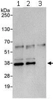Immunoprecipitation - Anti-BRCC36 antibody (AB115172)
