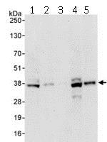 Western blot - Anti-BRCC36 antibody (AB115172)