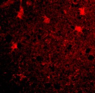 Immunocytochemistry/ Immunofluorescence - Anti-BRCC36 antibody (AB62075)