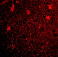 Immunocytochemistry/ Immunofluorescence - Anti-BRCC36 antibody (AB62075)