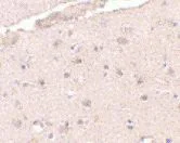 Immunohistochemistry (Formalin/PFA-fixed paraffin-embedded sections) - Anti-BRCC36 antibody (AB62075)