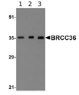 Western blot - Anti-BRCC36 antibody (AB62075)