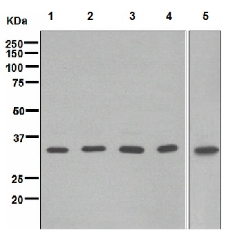 Western blot - Anti-BRCC36 antibody [EPR4365] (AB108295), expandable thumbnail