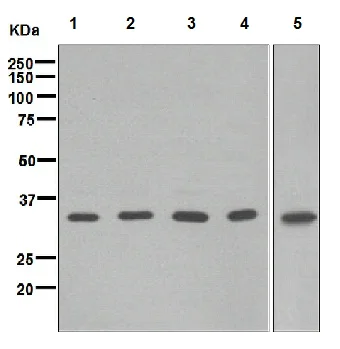 Western blot - Anti-BRCC36 antibody [EPR4365] (AB108295)