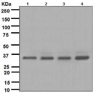Western blot - Anti-BRCC36 antibody [EPR4366] (AB108411)