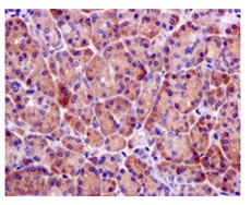 Immunohistochemistry (Formalin/PFA-fixed paraffin-embedded sections) - Anti-BRCC45/BRE antibody [EPR11858] (AB177960), expandable thumbnail