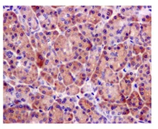 Immunohistochemistry (Formalin/PFA-fixed paraffin-embedded sections) - Anti-BRCC45/BRE antibody [EPR11858] (AB177960)