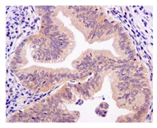 Immunohistochemistry (Formalin/PFA-fixed paraffin-embedded sections) - Anti-BRCC45/BRE antibody [EPR11858] (AB177960)