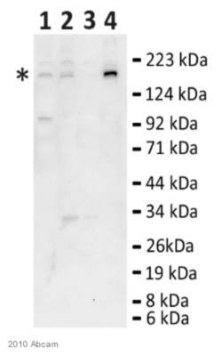 Western blot - Anti-BRD1/BRL antibody (AB71877), expandable thumbnail