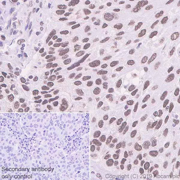 Immunohistochemistry (Formalin/PFA-fixed paraffin-embedded sections) - Anti-BRD1/BRL antibody [EPR12960] - BSA and Azide free (AB250317)