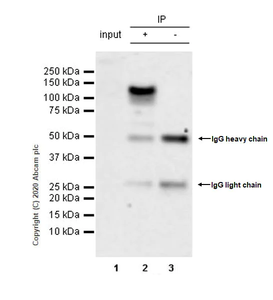 Immunoprecipitation - Anti-BRD1/BRL antibody [EPR12960] - BSA and Azide free (AB250317)