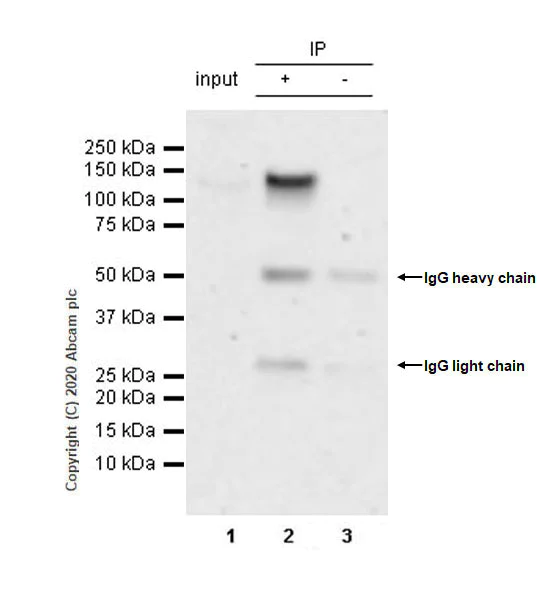 Immunoprecipitation - Anti-BRD1/BRL antibody [EPR12960] - BSA and Azide free (AB250317)