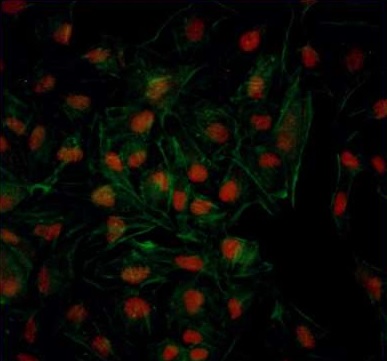 Immunocytochemistry/ Immunofluorescence - Anti-BRD2 antibody (AB245436), expandable thumbnail