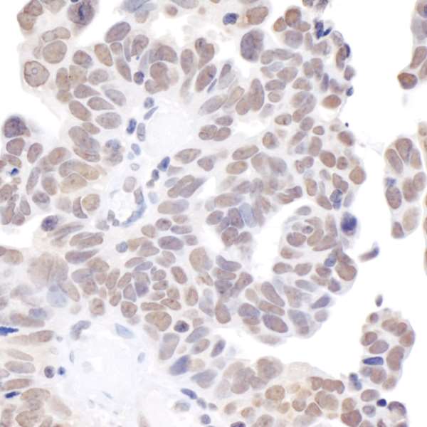 Immunohistochemistry (Formalin/PFA-fixed paraffin-embedded sections) - Anti-BRD2 antibody (AB245436), expandable thumbnail