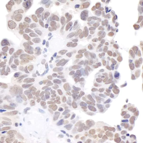 Immunohistochemistry (Formalin/PFA-fixed paraffin-embedded sections) - Anti-BRD2 antibody (AB245436)