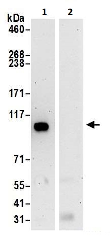 Immunoprecipitation - Anti-BRD2 antibody (AB245436), expandable thumbnail
