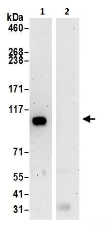 Immunoprecipitation - Anti-BRD2 antibody (AB245436)