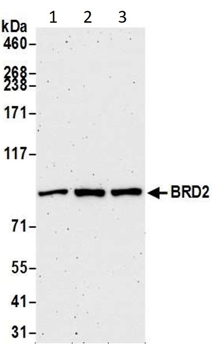 Western blot - Anti-BRD2 antibody [BL-167-2A2] (AB243865), expandable thumbnail
