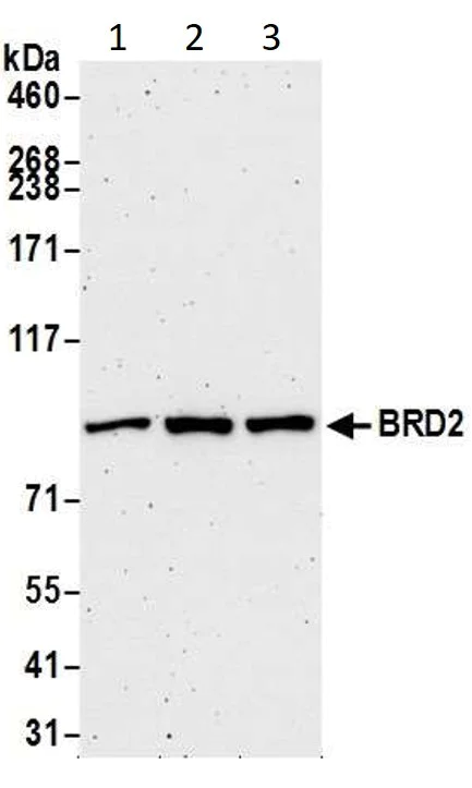 Western blot - Anti-BRD2 antibody [BL-167-2A2] (AB243865)
