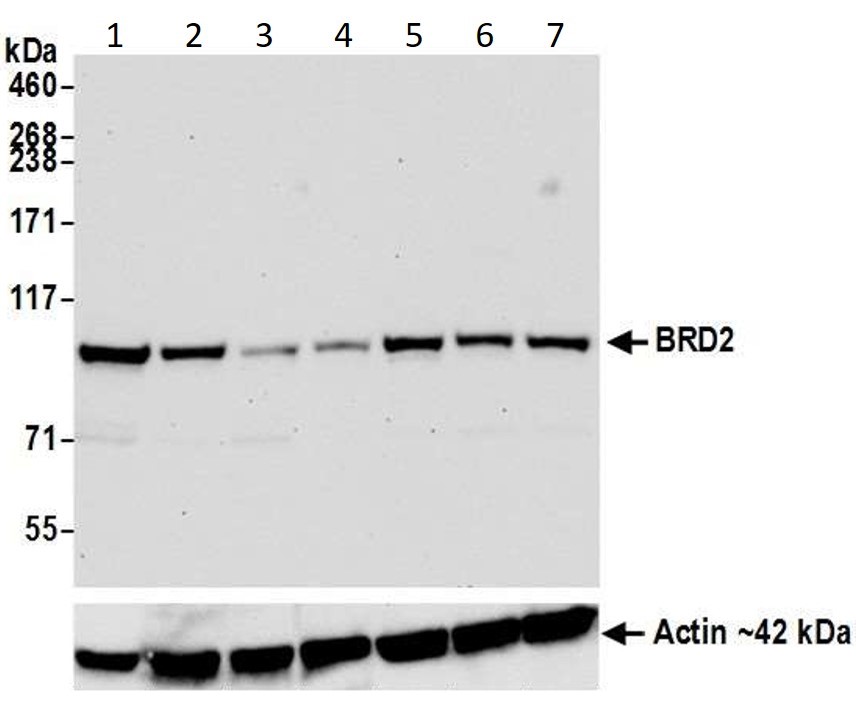 Western blot - Anti-BRD2 antibody [BL-167-2A2] (AB243865), expandable thumbnail