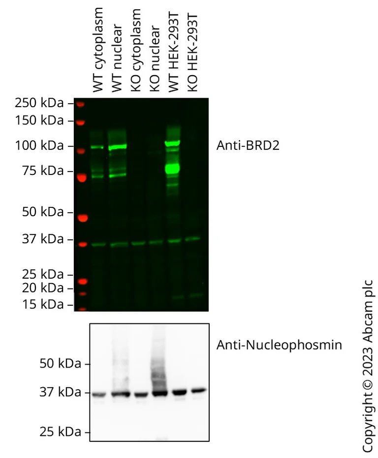 Western blot - Anti-BRD2 antibody [BL-167-2A2] (AB243865)