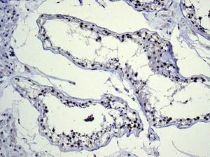 Immunohistochemistry (Formalin/PFA-fixed paraffin-embedded sections) - Anti-BRD2 antibody [EPR7642] - BSA and Azide free (AB222393)