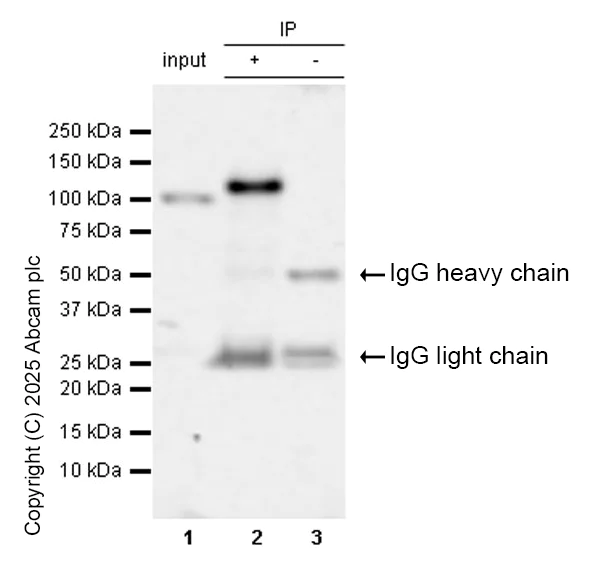 Immunoprecipitation - Anti-BRD2 antibody [EPR7642] - BSA and Azide free (AB222393)