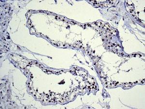 Immunohistochemistry (Formalin/PFA-fixed paraffin-embedded sections) - Anti-BRD2 antibody [EPR7642] - ChIP Grade (ab139690), expandable thumbnail