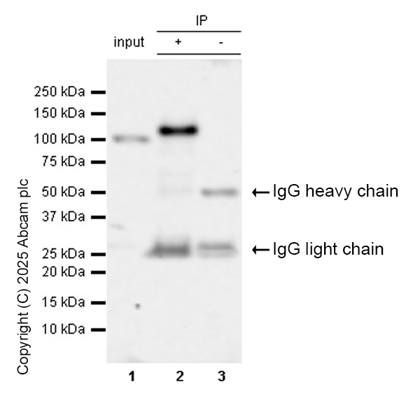 Immunoprecipitation - Anti-BRD2 antibody [EPR7642] - ChIP Grade (AB139690)