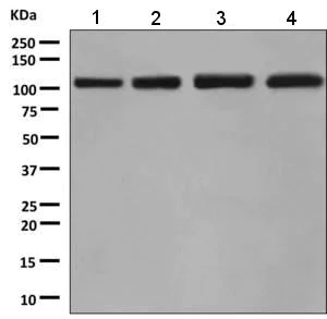 Western blot - Anti-BRD2 antibody [EPR7642] - ChIP Grade (AB139690)