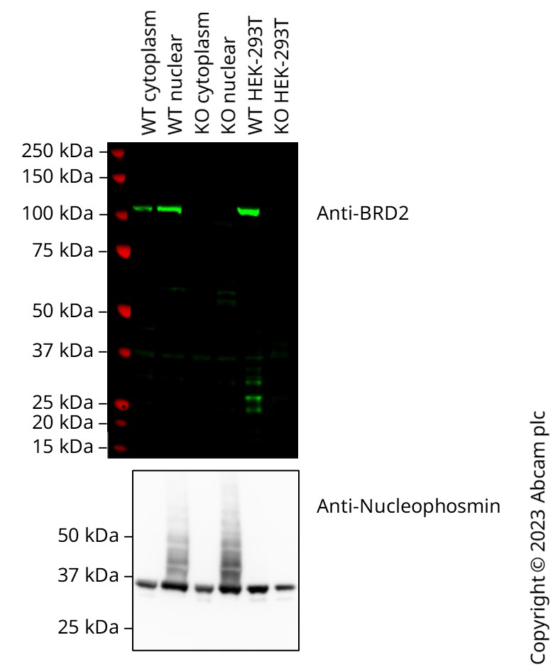 Western blot - Anti-BRD2 antibody [EPR7642] - ChIP Grade (ab139690), expandable thumbnail