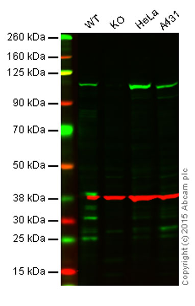 Western blot - Anti-BRD2 antibody [EPR7642] - ChIP Grade (AB139690), expandable thumbnail