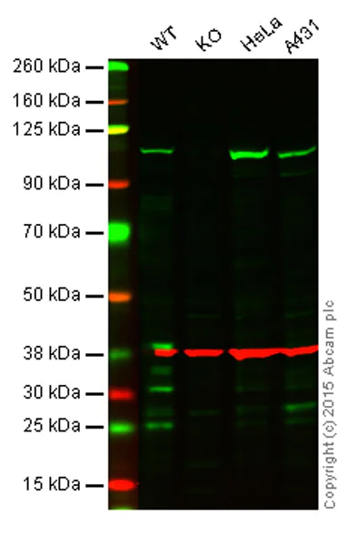 Western blot - Anti-BRD2 antibody [EPR7642] - ChIP Grade (AB139690)