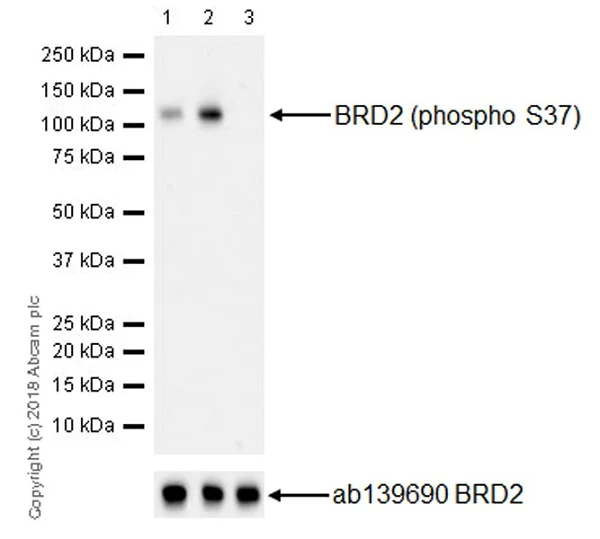 Western blot - Anti-BRD2 (phospho S37) antibody [EPR22114] (AB223255)