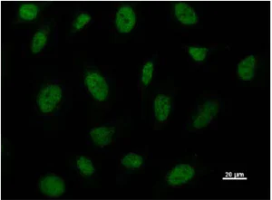 Immunocytochemistry/ Immunofluorescence - Anti-BRD3 antibody [2088C3a] (AB50818)