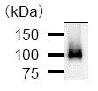 Immunoprecipitation - Anti-BRD3 antibody [2088C3a] (AB50818), expandable thumbnail
