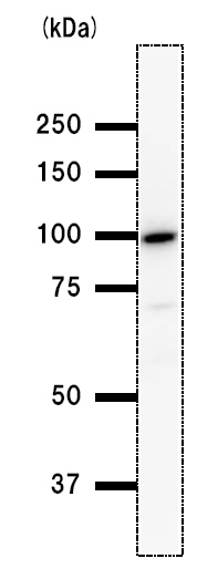 Western blot - Anti-BRD3 antibody [2088C3a] (AB50818), expandable thumbnail