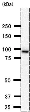 Western blot - Anti-BRD3 antibody [2088C3a] (AB50818)