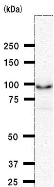 Western blot - Anti-BRD3 antibody [2088C3a] (AB50818), expandable thumbnail